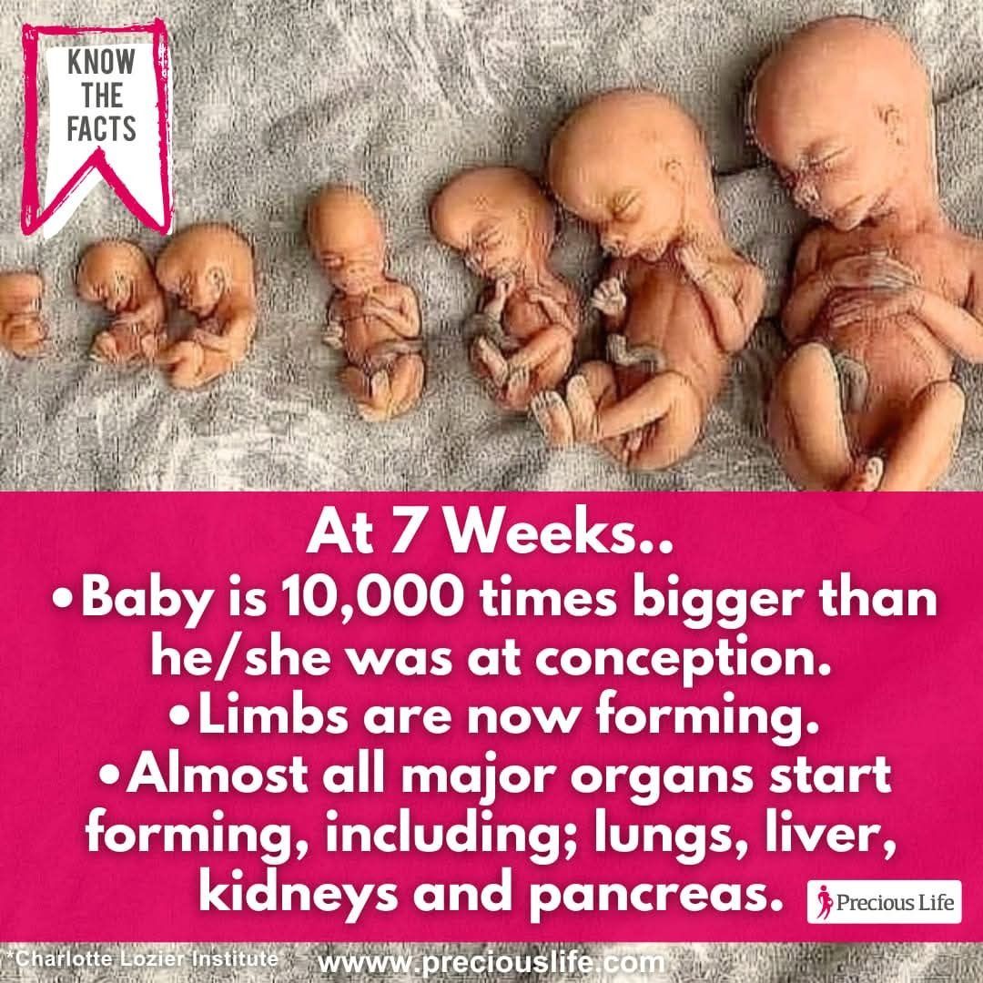 PreciousLifeCom's tweet photo. 💭 Did you know? At 7 weeks..
• Baby is 10,000 times bigger than he or she was at conception?
• His/her limbs are now forming.
• Almost all major organs start to form, including; the lungs, liver, kidneys and pancreas.
#GetTheFacts #DidYouKnow #fetaldevelopment https://t.co/btzo5dKvRc