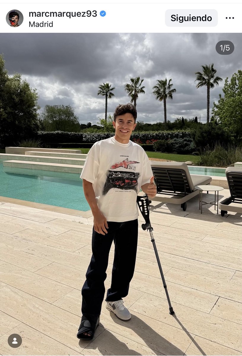 germax33's tweet photo. Primeras fotos de Marc Márquez tras la operación del domingo y ya en casa este lunes 💪 #MotoGP 
⏳ empieza la cuenta atrás 

https://t.co/h8BzOsCar0 https://t.co/i7SR0y5xwl