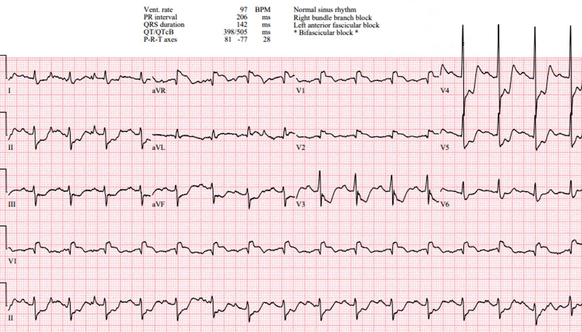 ECGWeekly tweet media
