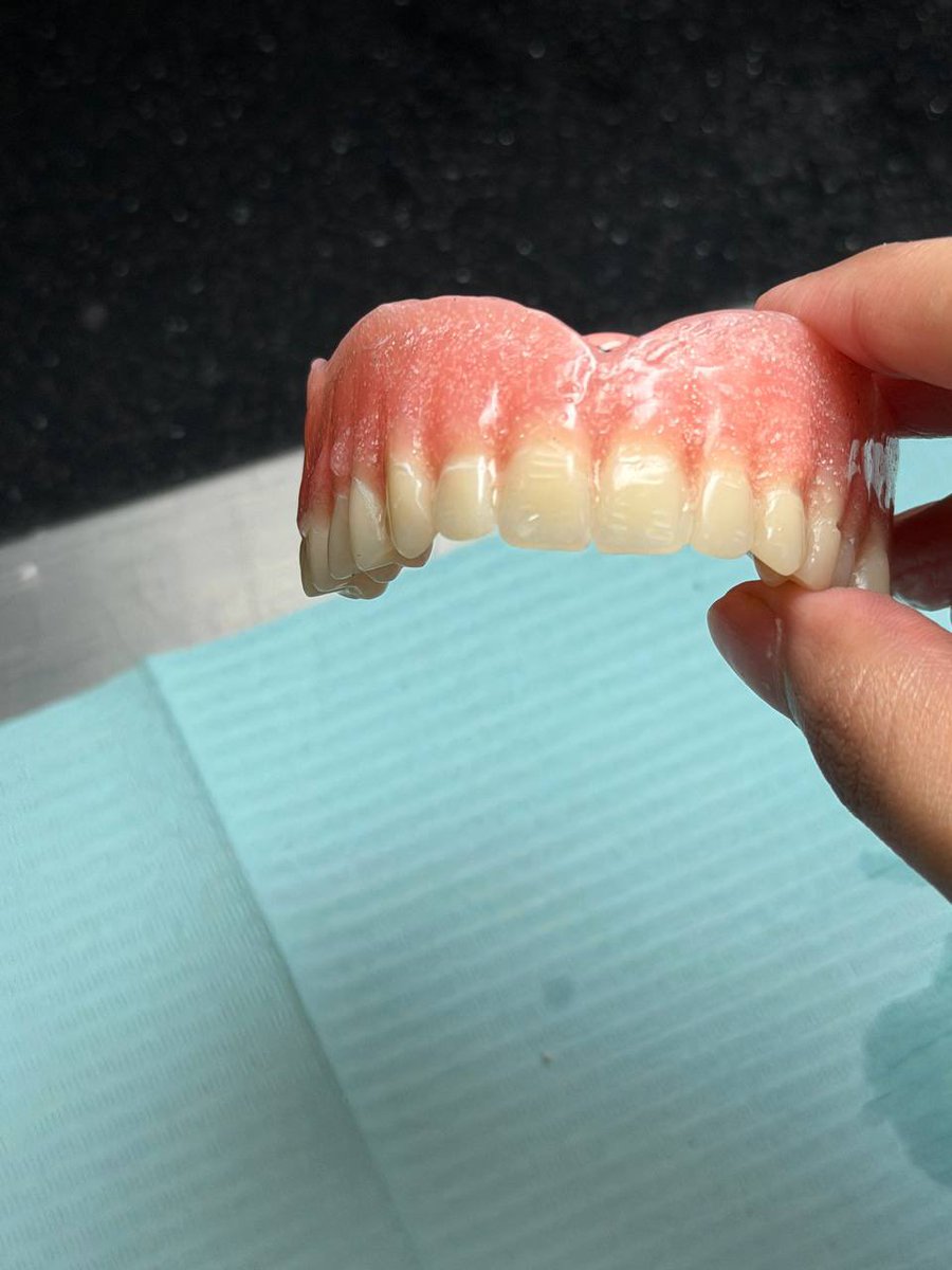 DLT445's tweet photo. نشارككم الـ Final Look لأطقم الأسنان في مادة الـ Complete Denture 🦷
رغم بعض التحديات البسيطة أثناء العمل، تم إنجاز الأطقم والوصول للنتي��ة النهائية.
نسعد بملاحظاتكم. https://t.co/4sTqfaQMa3