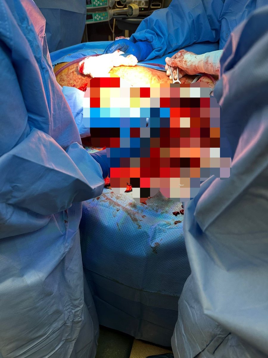 shaymads's tweet photo. Lost between surgery and life 🤎🩵 https://t.co/v3zDXbQ5Pc