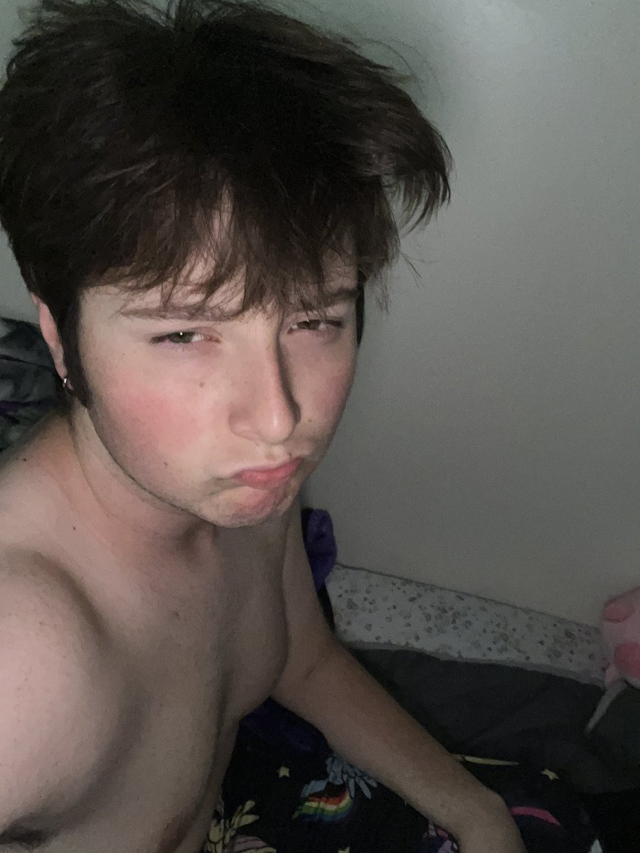 Adam Hyposelenia tweet media