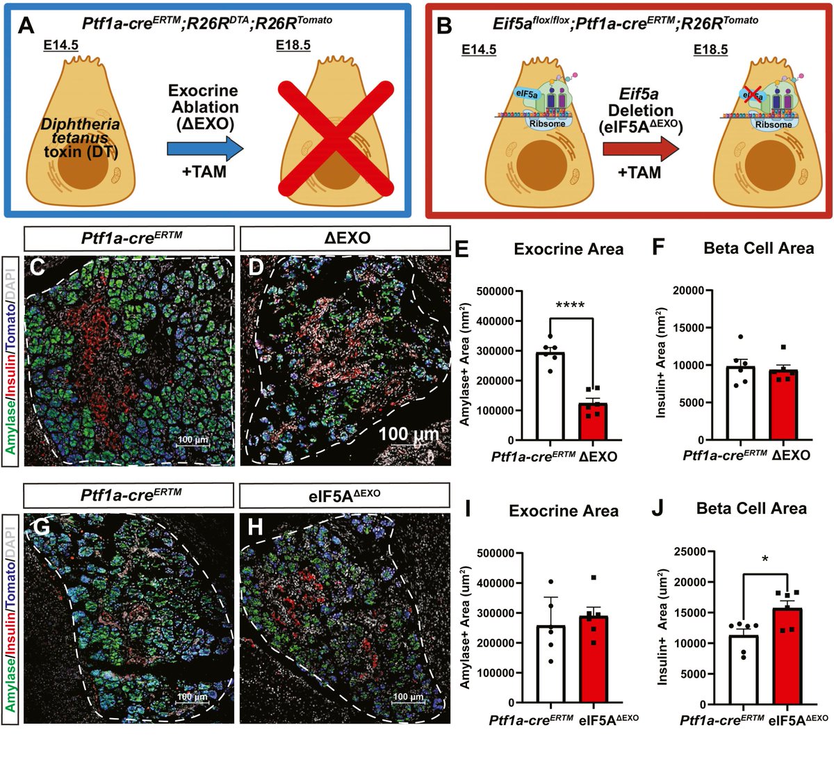 MolMetab's tweet photo. Loss of eIF5A in mice paradoxically expands functional #BetaCell mass alongside exocrine failure, revealing that on-demand protein synthesis controls pancreatic cell fate decisions via #NotchSignaling during development.

🔬@TeresaMastracci @IUIBiology
🔗https://t.co/6Fx2CFLy20 https://t.co/CTUftBFSGP