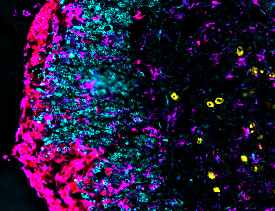 SciImmunology's tweet photo. A new Science #Immunology study identifies infiltrating #macrophages in the CNS as primary sources of ROS that drive neuroinflammation in mouse models of #MultipleSclerosis. @SarahMundt5 @VillarVesga https://t.co/AolkPs3UDs https://t.co/bsgVKsUCdL