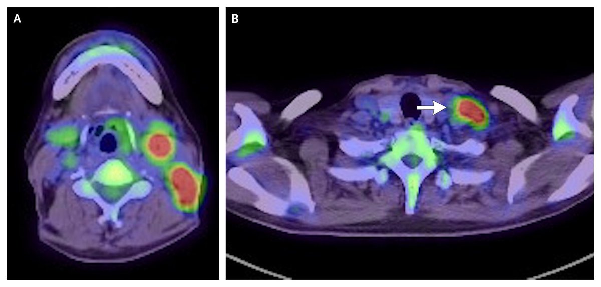 NEJM tweet media