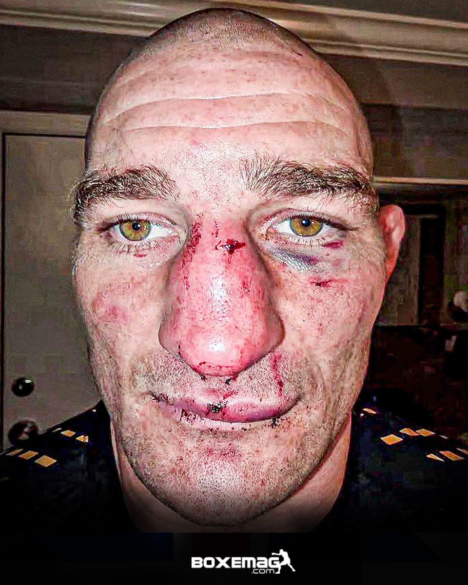 MBoyne71's tweet photo. @RobbieBarstool @TheMMA_Minute Not a war, 😂 https://t.co/xcRj1k7yCT