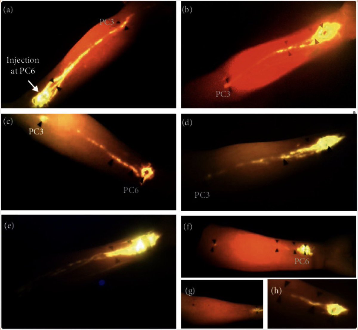 Boom! Scientists Discovered a Hidden Superhighway Inside You That Might Finally Explain Why Acupuncture Actually Works!

How tattooed skin biopsies proved something over 4,000 years old.

Buckle up…research just dropped a bombshell that is rewriting the human anatomy textbook