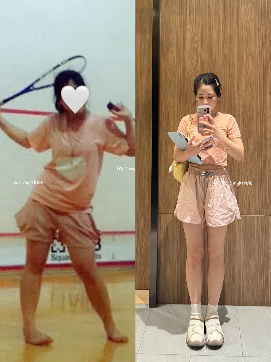 ตั้งแต่เกิดมาเพิ่งรู้ตัวว่าเดินลงน้ำหนักผิดมาทั้งชีวิต เลยน่องใหญ่จ่ะ !!! มาฝึกเดินลงน้ำหนักเท้าใหม่ได้ 2 เดือน ทรงน่องคนละเรื่องเลย +นวดน่องก่อนนอน +ยกขาสูงทุกวันด้วย มายก้อดด 

ใครที่น่องใหญ่เป็นมัดกล้าน่องปูดๆ ลองสังเกตุตัวเอง ว่าเดินลงน้ำหนักแรกที่ส้นเท้า