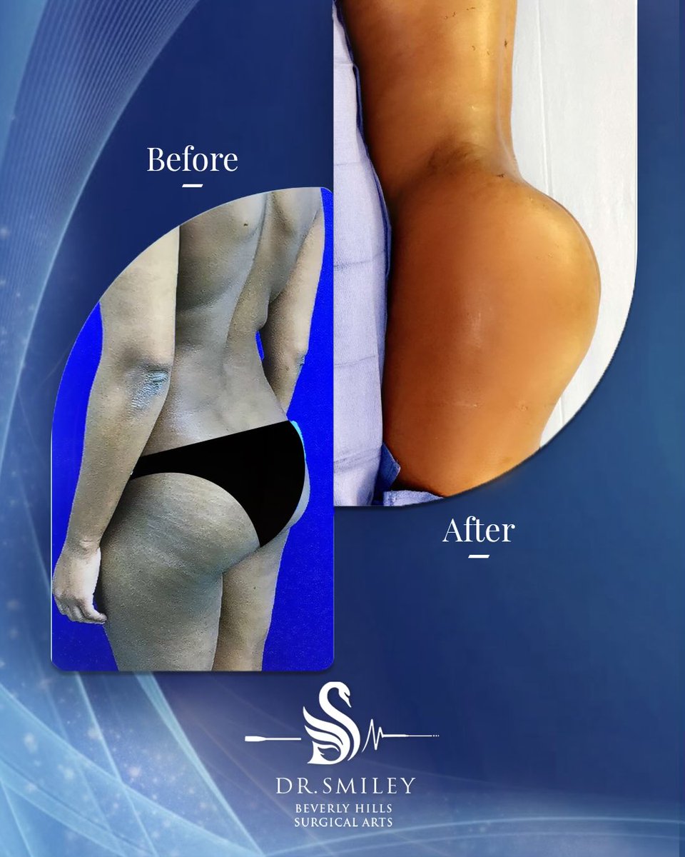 drsmiley_t's tweet photo. Real results. Real confidence.
 See the Dr Smiley’s difference , request your consultation today.

📞 Call us today: 1-866-372-3288 (Beverly Hills) | +971-50-505-3131 (Dubai) | +961-71-707-140 (Beirut) | +966-50-545-3131 (Saudi Arabia)

 #DrSmiley #PlasticSurgery #Confidence https://t.co/w3OdCBucZj