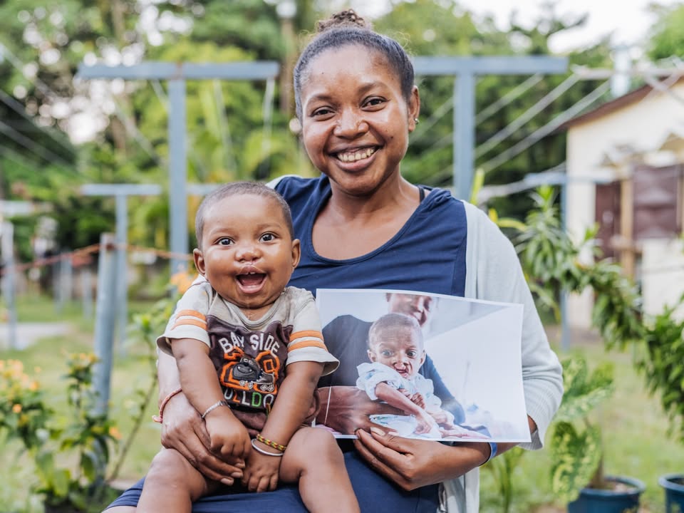 Mercy_Ships's tweet photo. Born premature in Madagascar with a cleft condition, Alfredo's mother feared for his survival and struggled to feed him.

She kept seeking help and eventually brought him to the #AfricaMercy, where he received the surgery he needed.

Today, Alfredo is healthy and thriving💙 https://t.co/6C4oEmZLUQ