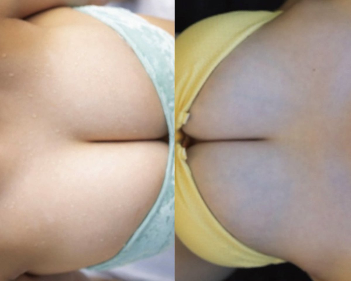 fumikayuka's tweet photo. G乳 vs. G乳 https://t.co/NxroH8dcDo