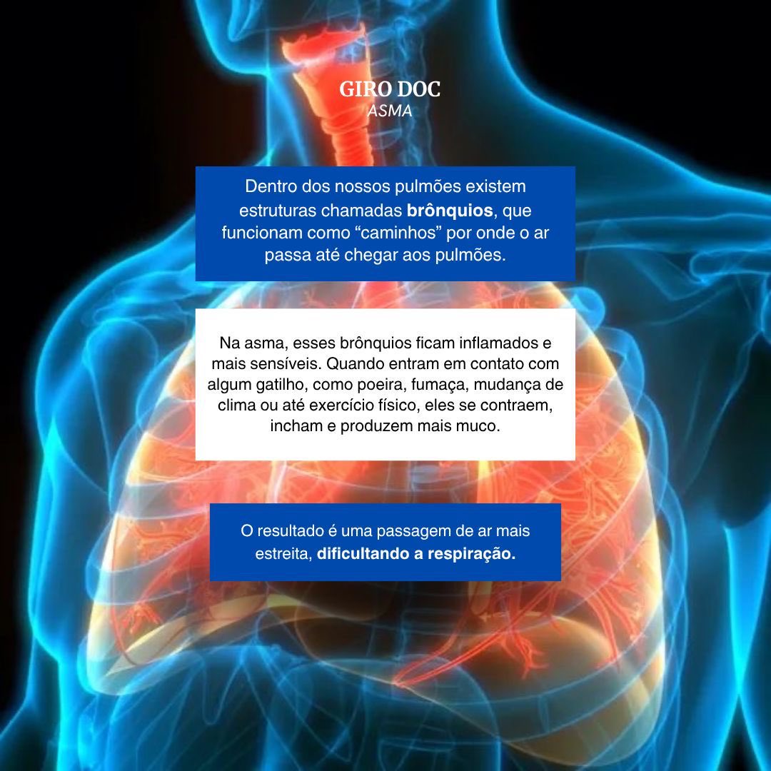 E pra entender isso, primeiro precisa entender o que acontece dentro do pulmão.

Porque a sensação de “ar preso” não vem do nada.
Existe uma resposta inflamatória acontecendo ali.