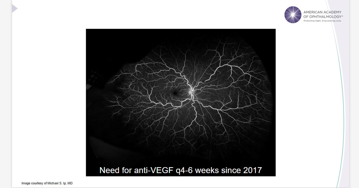 American Academy of Ophthalmology tweet media
