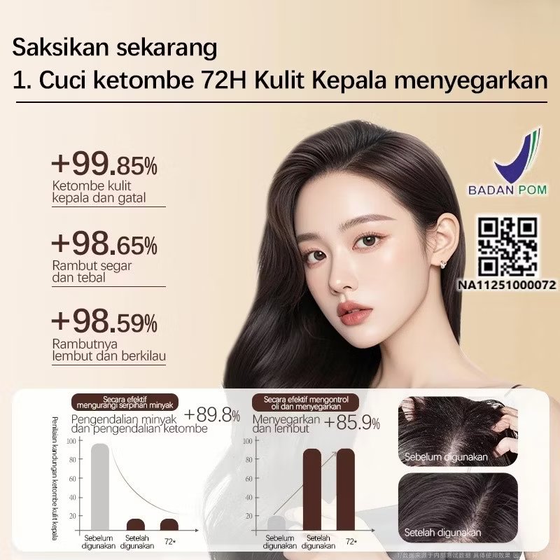 pocky_ling21's tweet photo. Buat yang punya masalah rambut rontok, ketombean bahkan kutuan, dan masalah rambut lainnya. Wajib cobain shampoo ini deh! 
https://t.co/EDtilDFSQ1 https://t.co/QWJ4jmtB3H