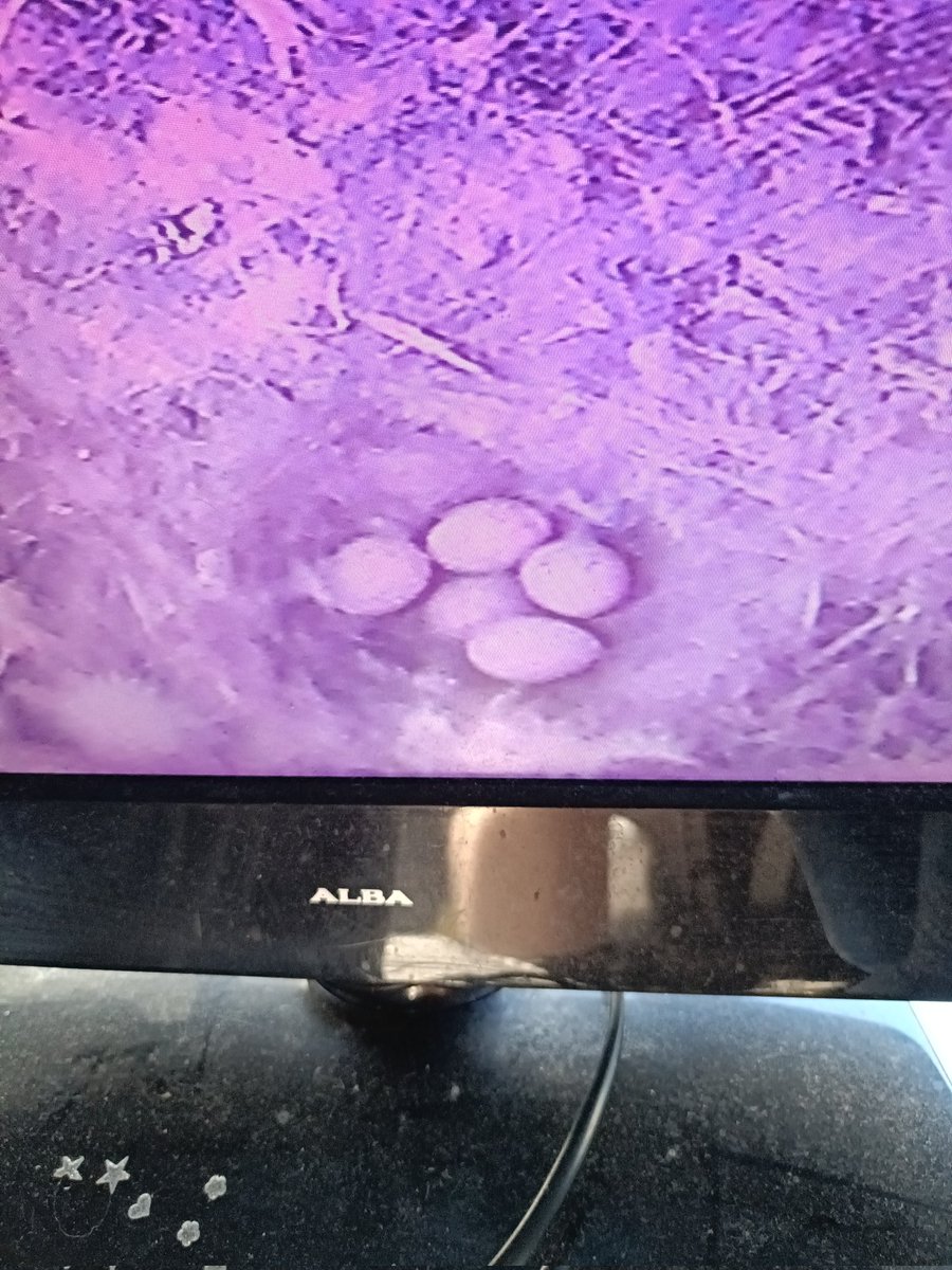 carllpool's tweet photo. Blue tit garden nest box update,five egg 🥚 @BBCSpringwatch https://t.co/iuaFAPPYP6