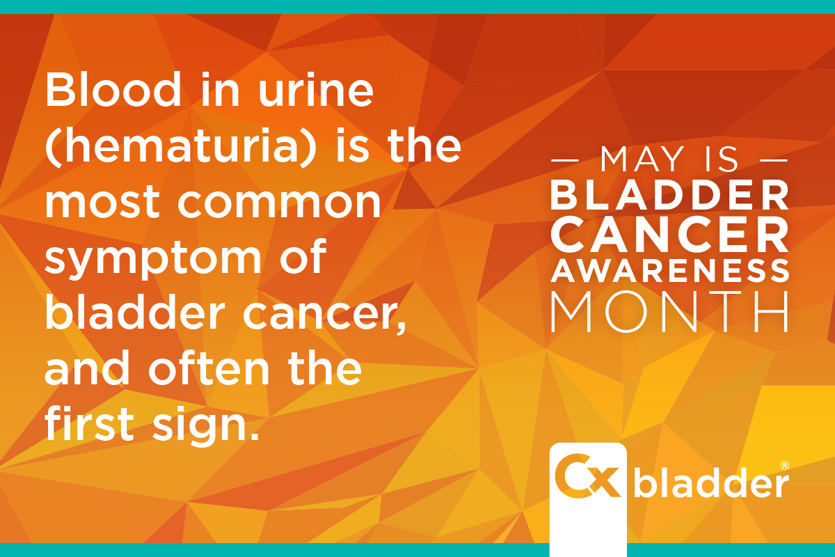 Cxbladder's tweet photo. Blood in urine (hematuria) is the most common symptom of bladder cancer and often the first sign. Hematuria is also one of the most common urologic conditions seen within clinical practice, with a prevalence of up to 31%*. 

Be #BladderCancerAware this May. Learm more about the signs and symptoms: https://t.co/EOrR7ASI58

#BCAM26 #BladderCancerMonth26 #BladderCancerAwarenessMonth

====
* Munroe et al. 2025. JMIR Form Res