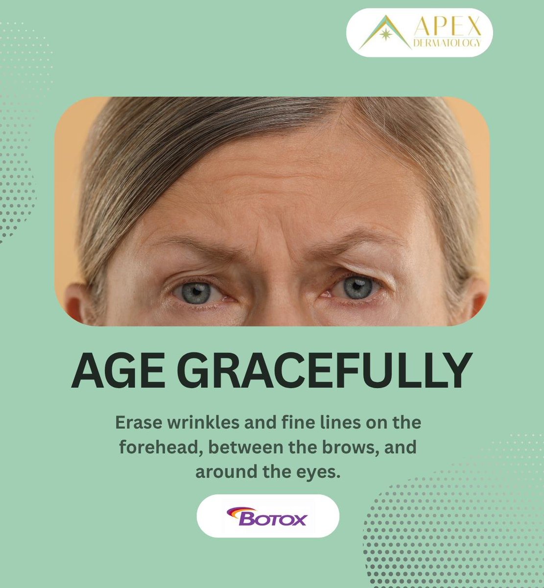 apex_derm's tweet photo. Botox is an FDA-approved treatment for reducing the appearance of facial wrinkles. Age gracefully with this anti-aging solution that requires no downtime.
.
.
.
https://t.co/uOyh8BbvAB
818-889-2739
32144 Agoura Road Suite 112, Westlake Village, California (CA) 91361
.
.
.
#botox https://t.co/mYAb0b03Ua