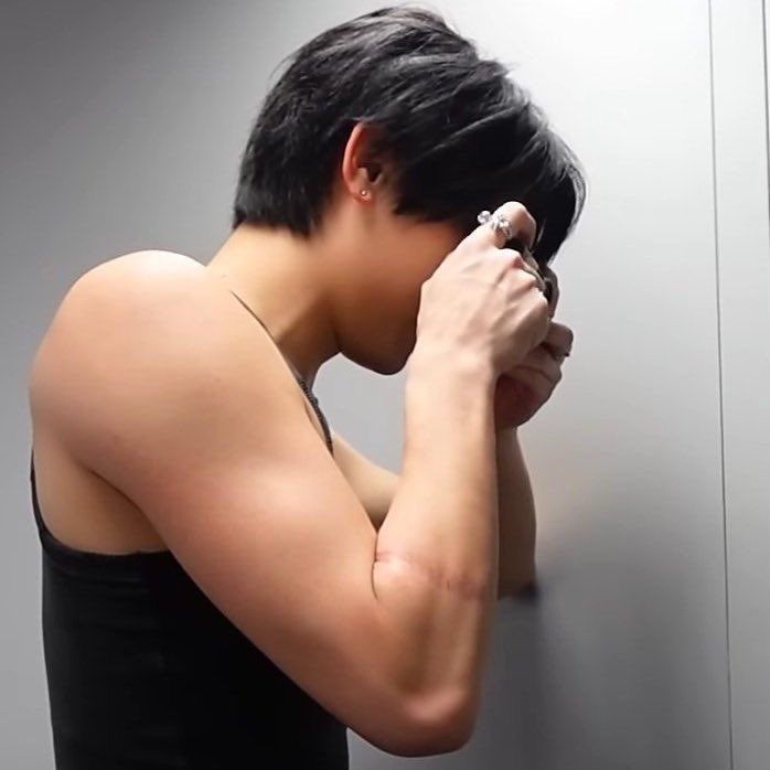 They may be able to edit it out but scars are beautiful and should not have to be hidden for aesthetics