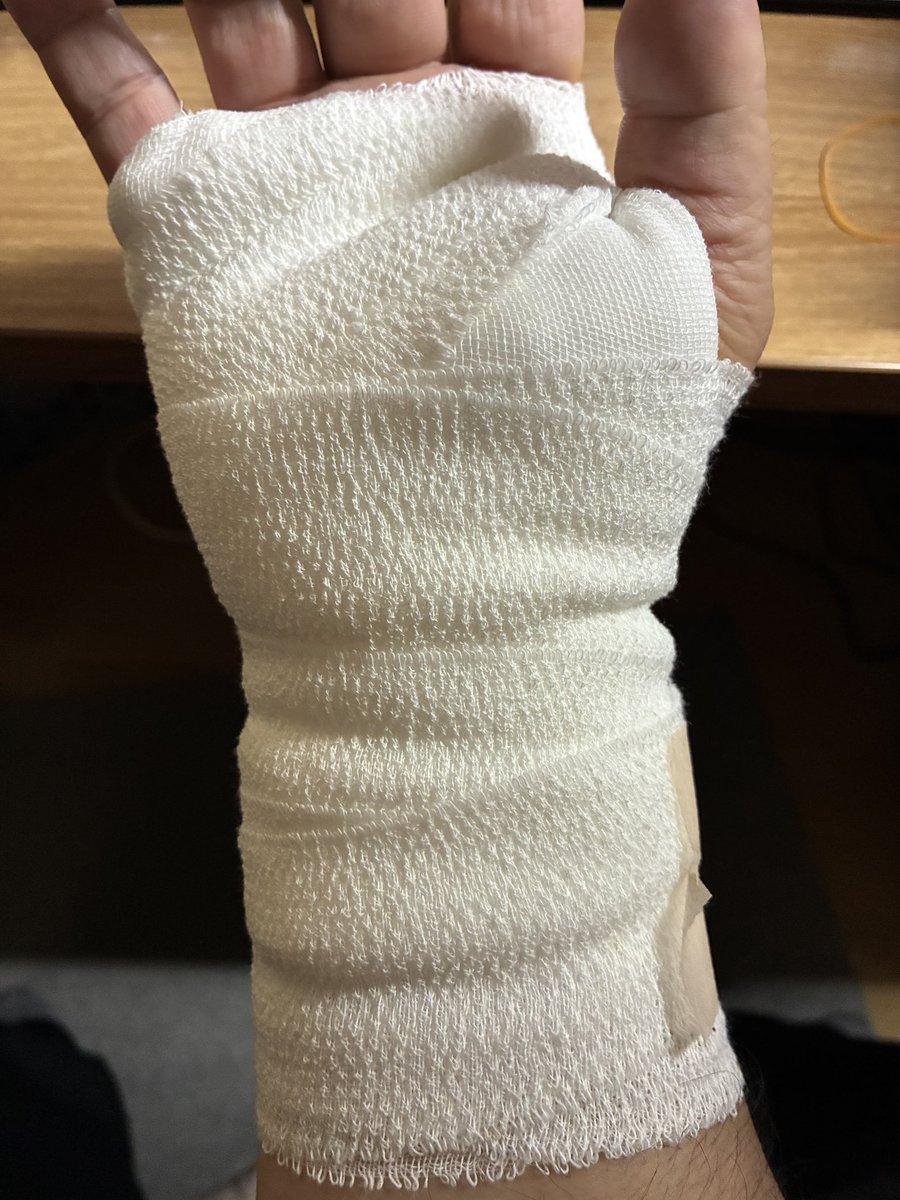 Udak987's tweet photo. 手術してきた。
酷い状態だったらしく、神経が圧迫されて、すごく細くなっていたらしい。
#手根管症候群 https://t.co/O3dayktwGm