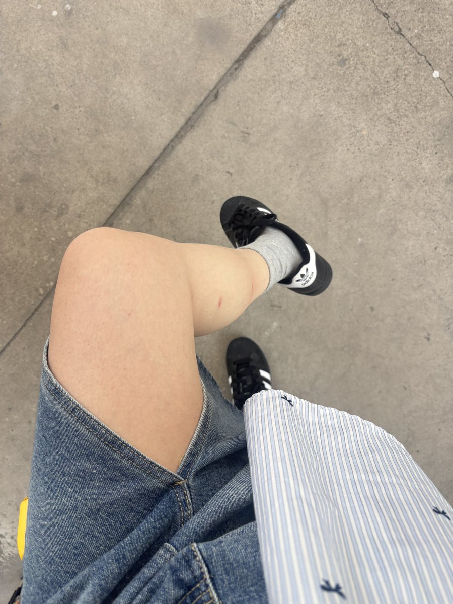 卖萌被肘击 tweet media