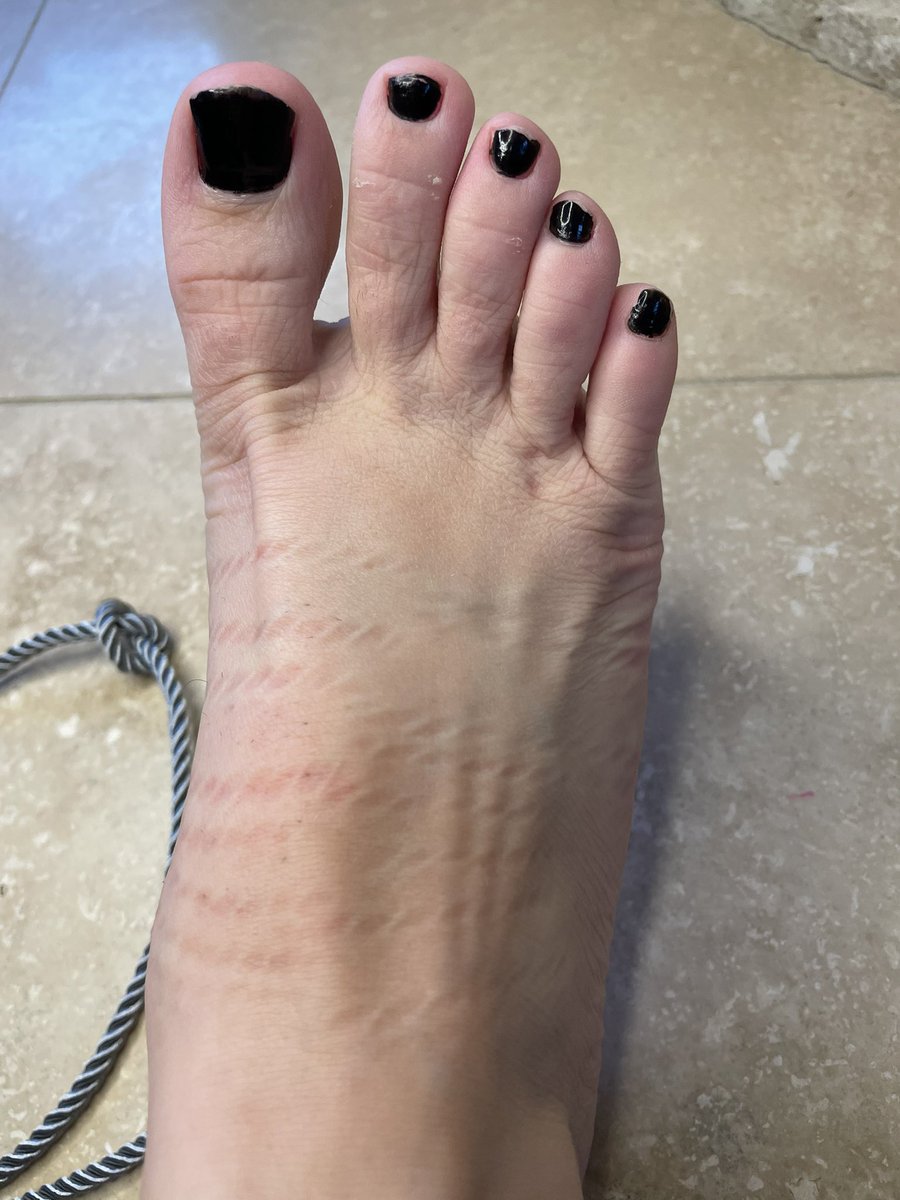 LittleRunningToes tweet media