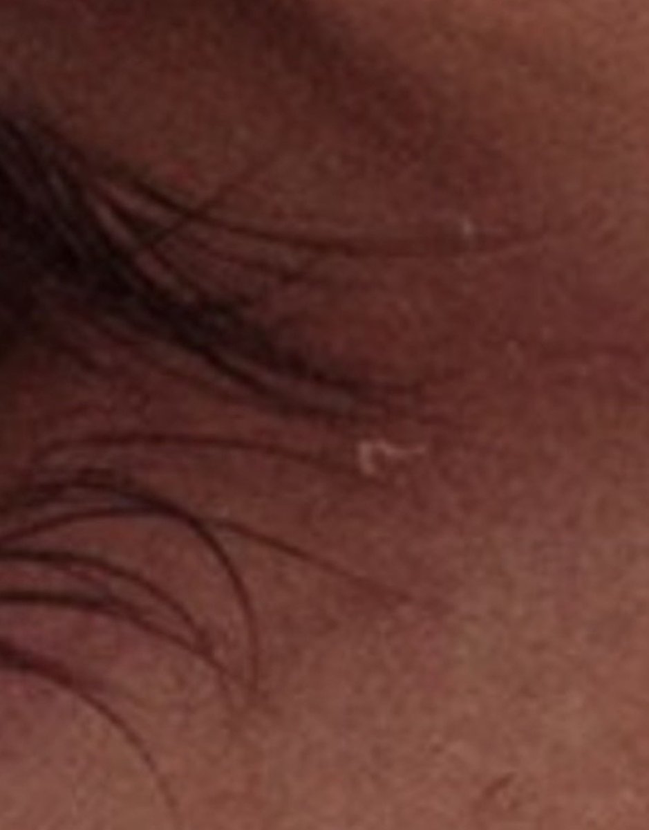 the eye boogie😭😭😭😭😭