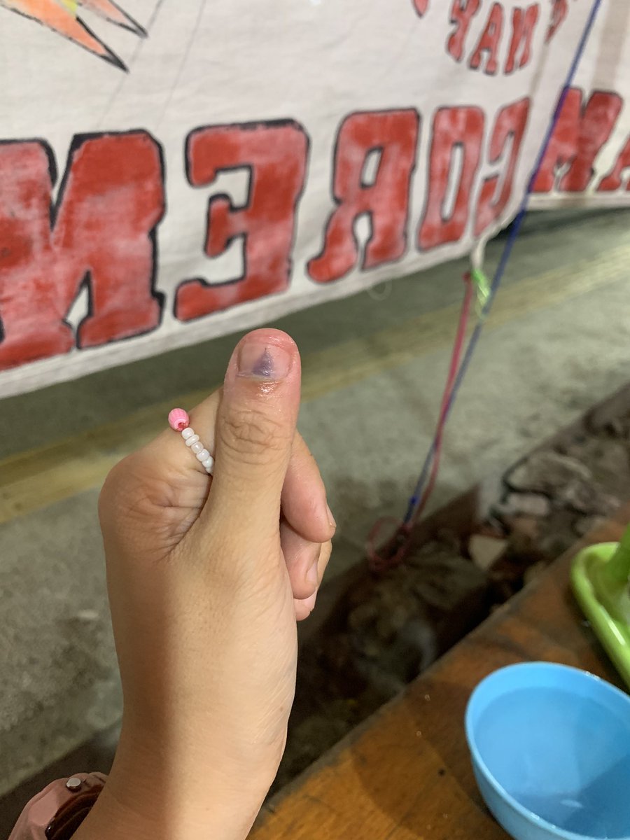 malangkpoptur's tweet photo. Pertama kali ngerasin. Ngobatinnya gimana guys?? Sampe siang msh byut2 banget parahhh https://t.co/MXZiqHQwUd