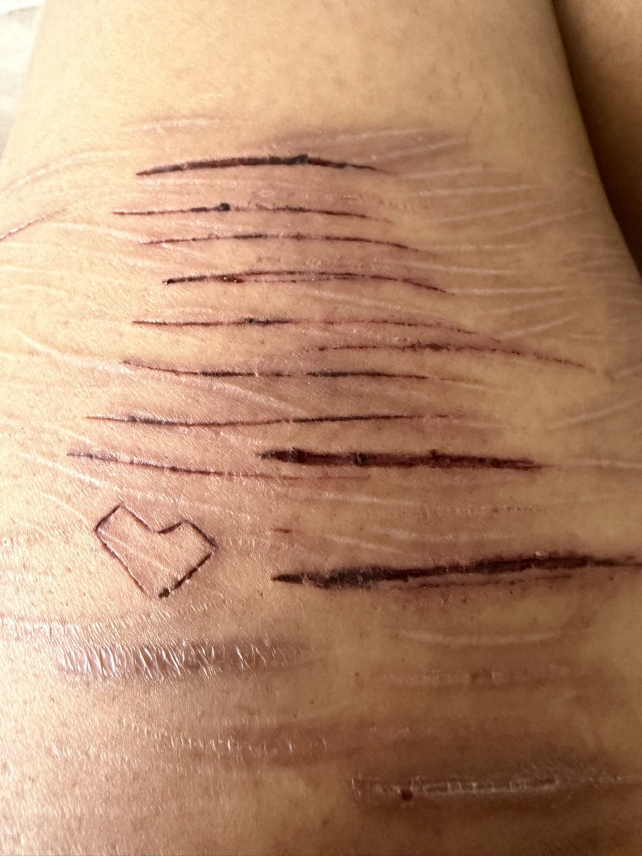 Kenny01098's tweet photo. I think these scabbed up really cute #shedtwt #shtet #slittwt https://t.co/JPOlSpD8Ec