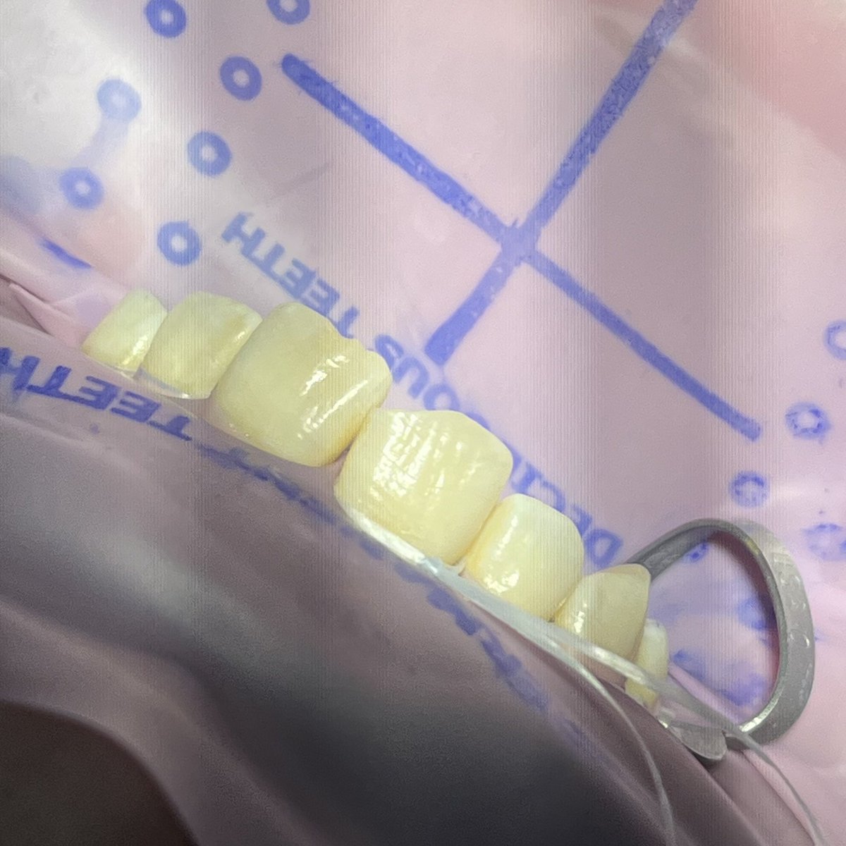F99lz's tweet photo. Today’s Resto Case🧼
-ALT- https://t.co/8Ra6rbRGUv