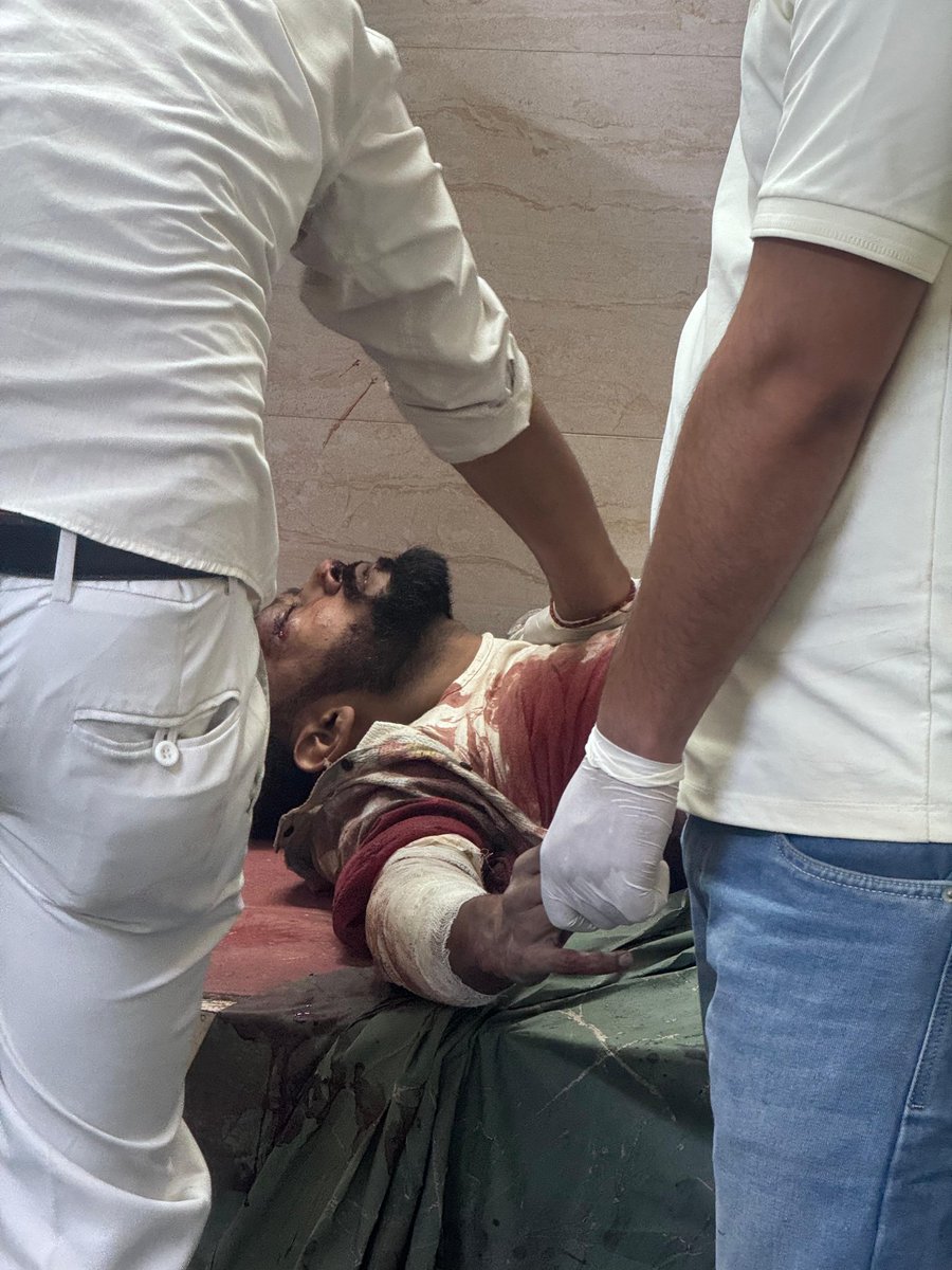 Mrtiwari's tweet photo. 🚨🚨 Help! Urgent request! 🙏🙏

शुक्रवार को नोएडा एक्सटेंशन में एक बेहद दर्दनाक हादसा हुआ।

28 वर्षीय अभिषेक अपनी बेटी को स्कूल से लेकर घर लौट रहे थे, तभी एक तेज़ रफ्तार ट्रक ने उन्हें टक्कर मार दी। बेटी को हल्की चोटें आईं, लेकिन अभिषेक गंभीर रूप से घायल हो गए। उनके सिर में कई फ्रैक्चर हैं और हाथ पूरी तरह क्षतिग्रस्त हो चुका है। डॉक्टरों का कहना है कि उनका हाथ काटना पड़ सकता है।

अभिषेक फिलहाल यथार्थ अस्पताल में भर्ती हैं, जहां इलाज का खर्च परिवार की क्षमता से बाहर हो चुका है।

उनकी पत्नी और छोटी बेटी अब पूरी तरह लोगों की मदद और crowdfunding पर निर्भर हैं।

कृपया आगे आएं, मदद करें और इस पोस्ट को ज्यादा से ज्यादा शेयर करें। एक छोटी मदद भी एक परिवार को टूटने से बचा सकती है। 🙏

Account Holder Name: Shivani Kashyap

* Account Number: 6748980772
* IFSC Code: KKBK0005321
* UPI ID: 7060521639@kotakbank

Contact Person : Shivani (wife)
Mobile No, 7060521639

Hospital:  Yatharth Hospital Greater Noida 

Name of victim: Abhishek Wife Shivani