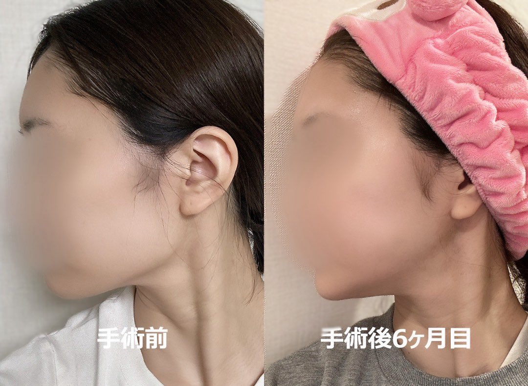 いしつよ希望 tweet media