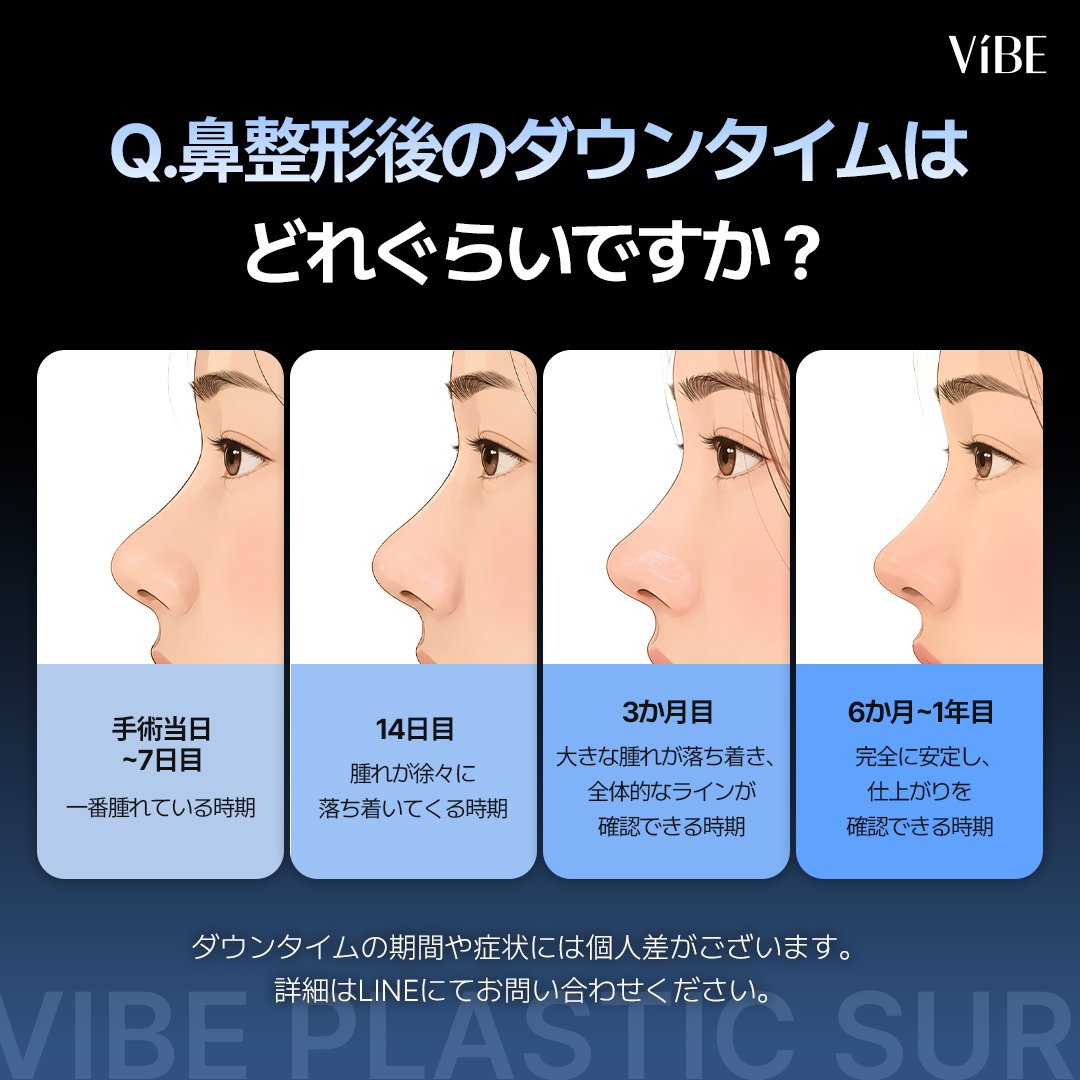 vibeprs's tweet photo. Q. 鼻整形後のダウンタイム、どれぐらい必要❓

大事な予定前は腫れも考慮して
早めの手術がおすすめ✔️

#韓国クリニック #鼻整形 #ダウンタイム #鼻の再手術 #美容整形

ダウンタイム中に絶対NGな行動は？
⬇️続きはスレッドで紹介します https://t.co/hNFHsfPLiY