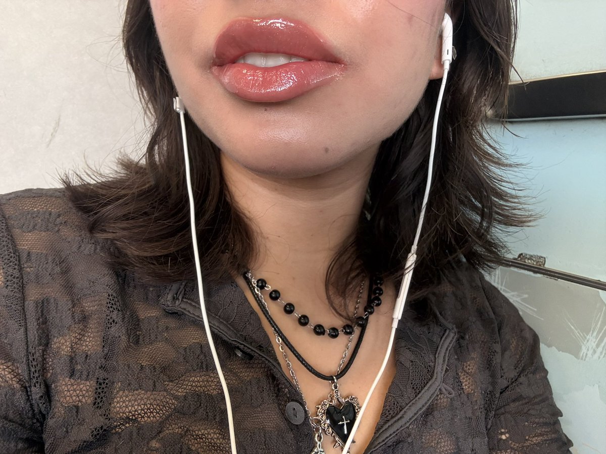 Acidita tweet media