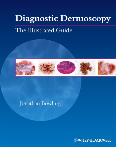 imulibrary's tweet photo. 📢 Diagnostic Dermoscopy : The Illustrated Guide by Jonathan Bowling is now available on Wiley Online Library

🔗Read e-book here: https://t.co/ZnPgw03Ejq

Thank you
#IMUUniversityLibrary #eBooks #WileyOnlineLibrary https://t.co/nTcSLaAI9q