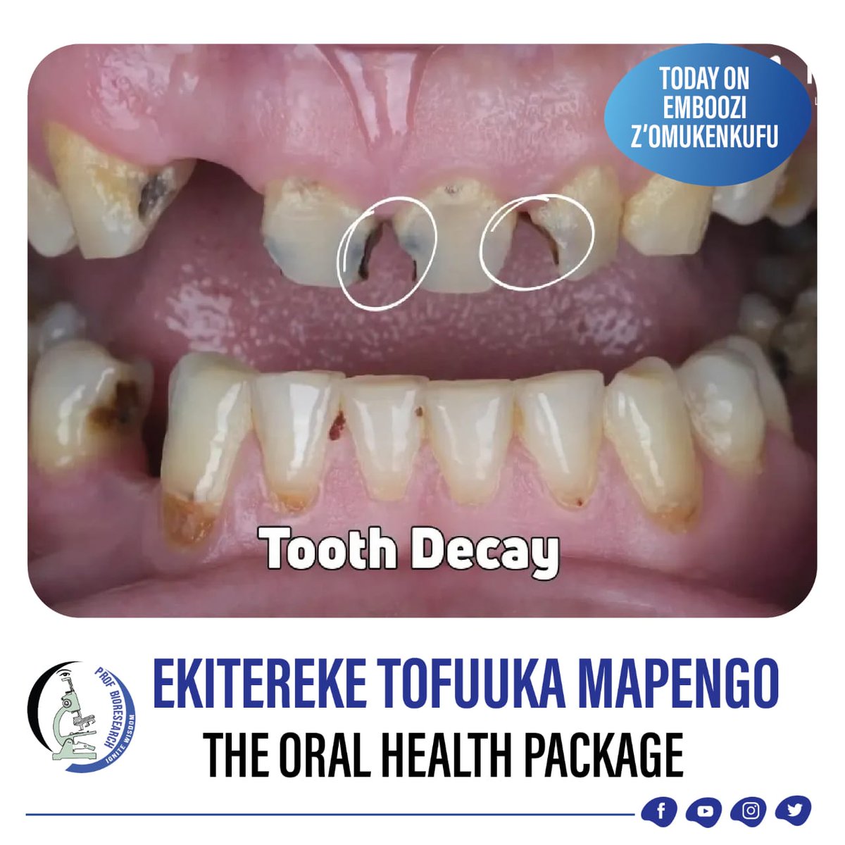 profbioresearch's tweet photo. EKITEREKE TOFUUKA MAPENGO- THE ORAL HEALTH PACKAGE 

GRAB THE DISCOUNTED OFFER PRODUCTS TODAY!

📻 LIVE ON AKABOOZI FM
🗓 Every Tuesday
⏰ 10:30 AM
📡 Live Stream: https://t.co/DHDN9c0qPy

🌹 Don’t miss Emboozi z’Omukenkufu!

🔍 Key Topics of Discussion https://t.co/JK9KHU7xQO