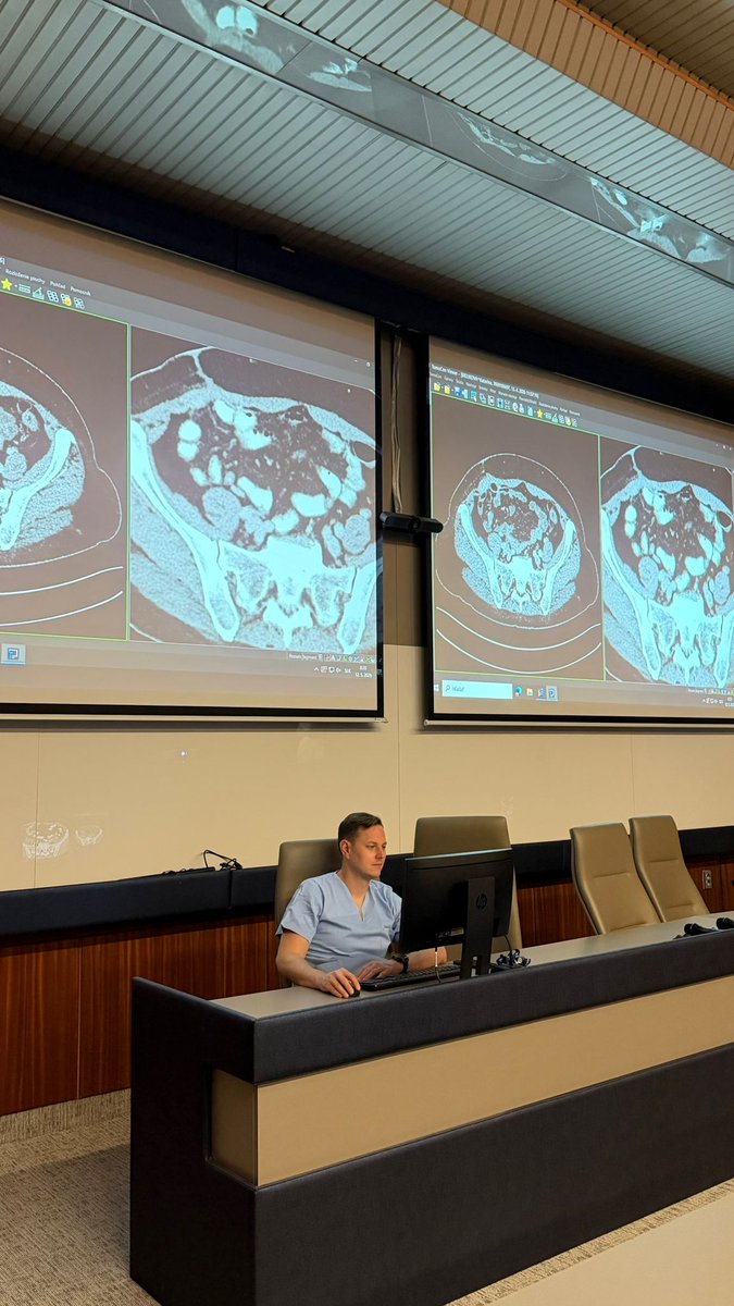 ECIOcongress's tweet photo. #ECIOtakeover with Marek Makovnik 

☀️ What is the best way to start the day?

A multidisciplinary tumor board.

#ECIO2026 #TumorBoard #InterventionalRadiology #InterventionalOncology #Radiology #CancerCare #MultidisciplinaryCare #Oncology https://t.co/7EulHyjmg2