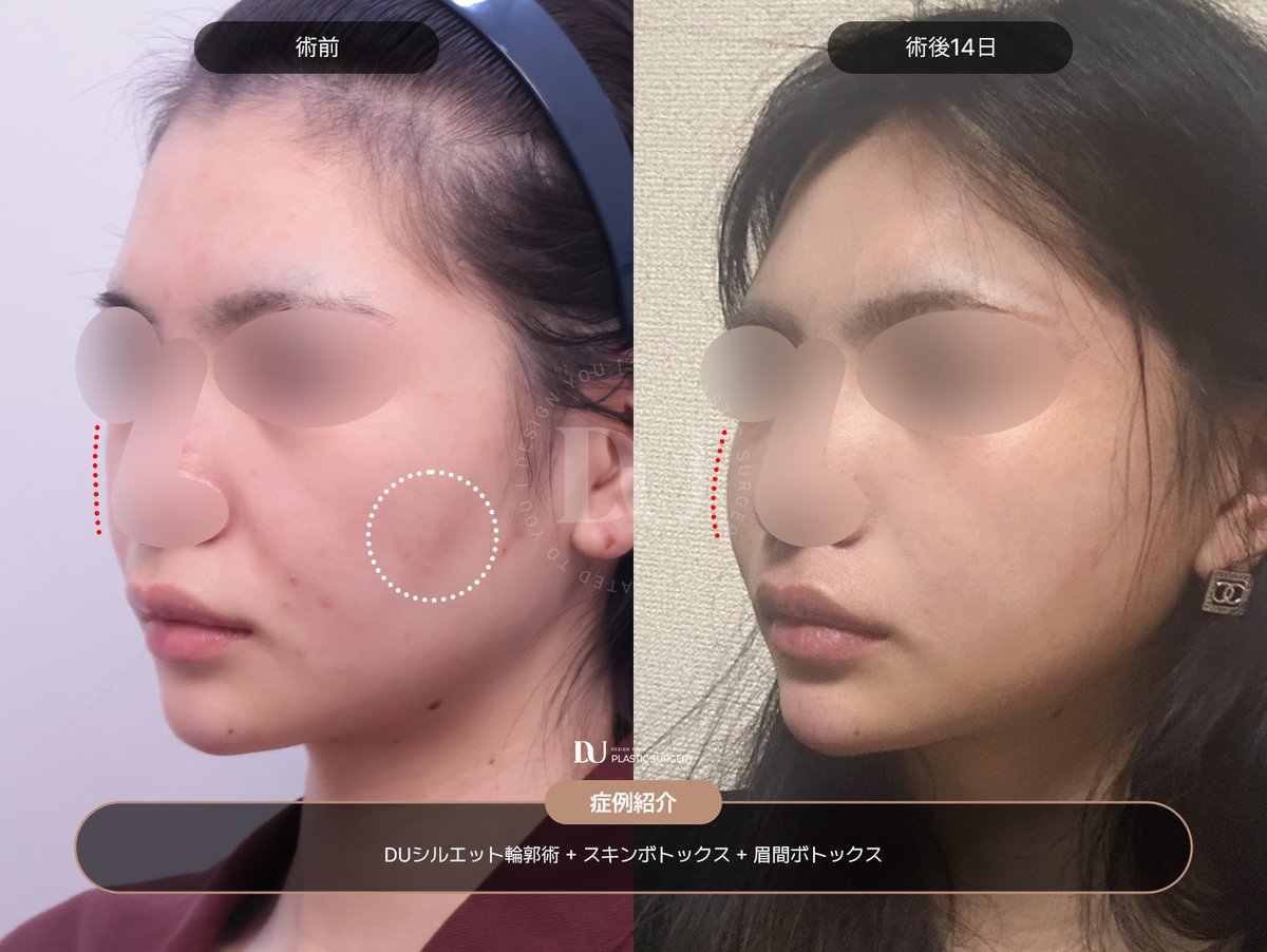 DU美容外科 - 本来の美しさを引き出します✨ tweet media