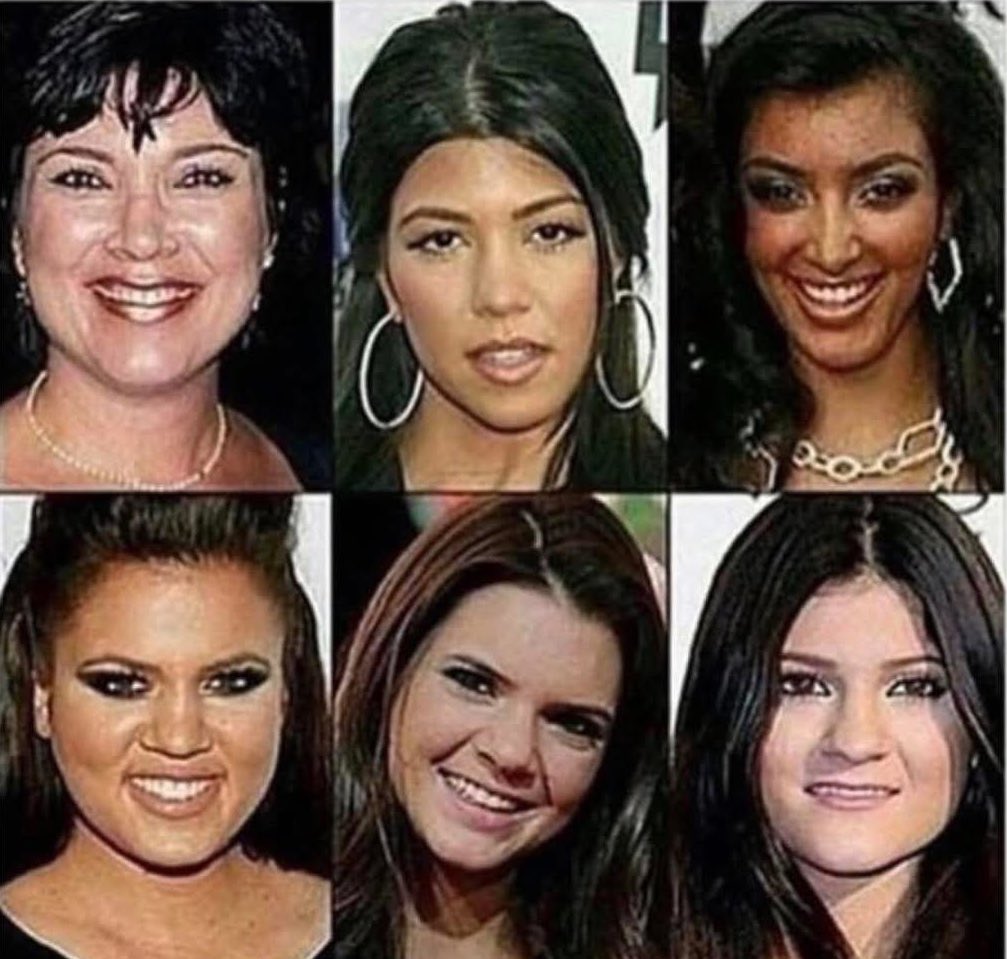 gimmickthegnome's tweet photo. Remember, you're not ugly.
You're just poor. https://t.co/QWGauTscW8