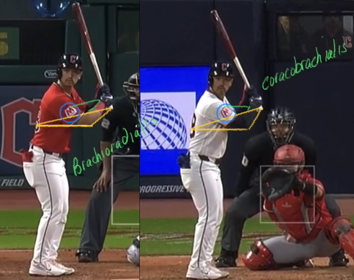 tommym8's tweet photo. Steven Kwan is 0 for his last 12 and his batting avg is down to .208….

He was hitting .331 on May 12, 2025….

Back then Steven was using the muscles of motor tract 1 on the right side of his body….

He’s been using the muscles of motor tract 5 on his right side on every swing this season….

Look how different his stance looks in each instance….

2025 on left vs 2026