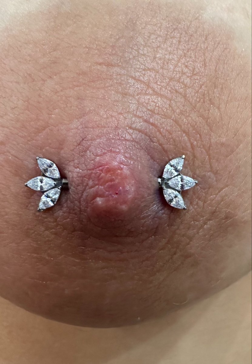 piercedbynatan's tweet photo. Nipple Piercing made with titanium jewelry 14g (1.6mm) DM FOR bookings and infos #nipple #nipplepiercing #mamilopiercing #piercingmamilo #mamilo https://t.co/YGVwabMssf