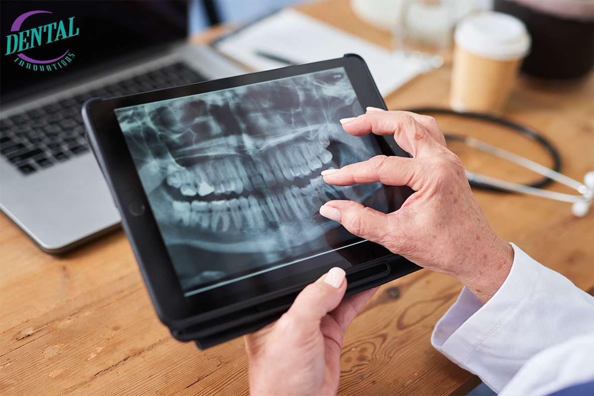 Dental_Inn_Chi's tweet photo. Staying consistent with your dental checkups is one of the easiest ways to avoid costly treatments later. At Dental Innovations, we make it simple to stay on track with preventive care that’s designed to keep your teeth and gums in their best shape. https://t.co/LPTP3ELs44 https://t.co/H58OZf5bXg
