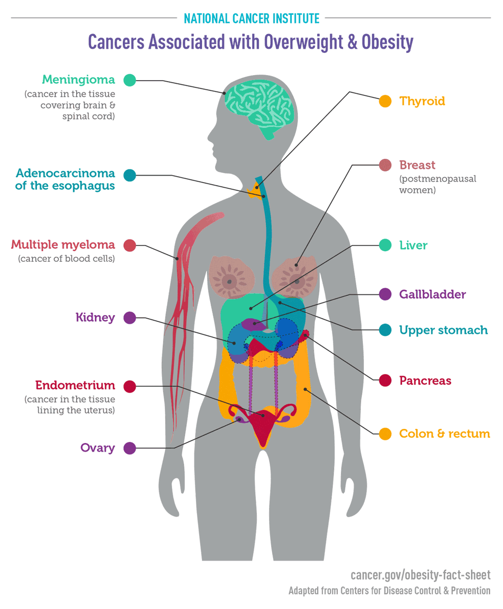 bava23's tweet photo. @RuxandraTeslo @WorksInProgMag Great to hear this innovative new treatment!!
We also all need to understand that we should all do more preventative measures to reverse INSULIN RESISTANCE to prevent pancreatic cancer in the first place. 73% of adults at risk. #3SimpleSteps https://t.co/PzTlxdOQyZ