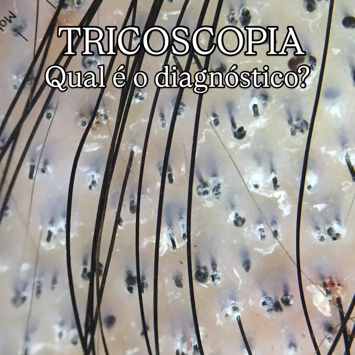 Dermatologia's tweet photo. Você fecha o diagnóstico com essa imagem? https://t.co/aNK1LbGBGs
