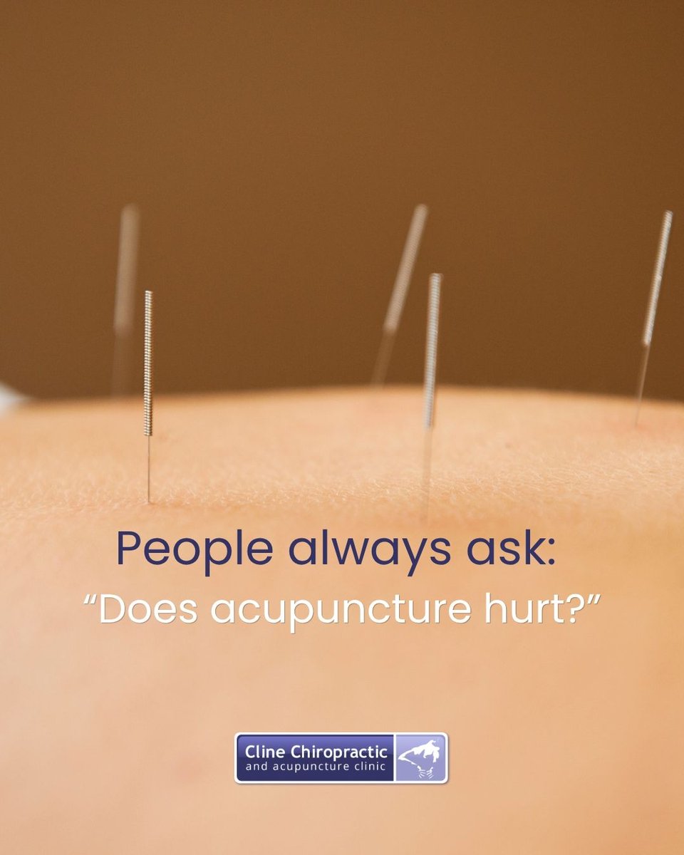 DrAdamCline's tweet photo. People always ask: “Does acupuncture hurt?”

Most people are surprised to find that acupuncture is very gentle. The needles are extremely thin, and many patients feel relaxed or even sleepy during treatment. It’s a calming experience more than anything.

https://t.co/VWm4QkFNdX https://t.co/C9U0UA8uBx