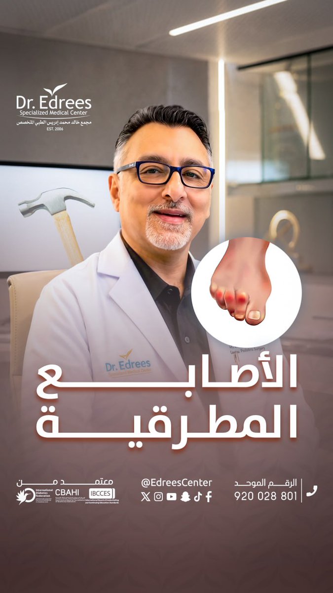 EdreesCenter's tweet photo. 🦶✨ تصحيح الاصابع المطرقية
عملية بسيطة تساعد على إعادة استقامة الإصبع وتخفيف الألم وتحسين المشي.
لأن راحتك تبدأ من قدميك  #رواد_طب_وجراحة_القدم_والكاحل في الوطن العربي

📞 للحجز والاستفسار:
📱 +966500506507
☎️ 920028801
🌐 https://t.co/N9ugvdiyrS

#طب_القدم #القدم_السكرية #جراحة_القدم #خالد_ادريس #عيادات_جدة #مجمع_طبي #عناية_القدم #قدم_صحية #مسمار_القدم #الكاحل #الاخمصي #غرغرينة #بتر #إبهام #أظافر #فطريات #تقرحات #الظفر_المنغرز #شاركوت #كسور #عظام #إصابات_الاربطة #اصابع_مطرقية #تشوهات_خلقية #قدم_حنفاء #وتر_العرقوب

 #footcare #dredrees