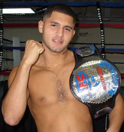 Imhec's tweet photo. @kastheactivist @jaqwagon @sajad98M @acdmma_ He did have that sort of hairline at one point, but it obviously doesn’t match his now 40+ year old facial features https://t.co/xRpTOGncqV