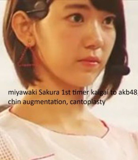 yoongina tweet media