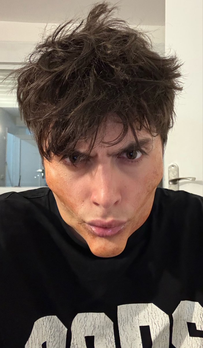 Decidle hola a mi nuevo yo 🛠️⚡️

Aún tiene que bajarse la inflamación pero os MOGGEO BRUTALMENTE a todos incluso recién operado 😂😂

SEGUID ENVIDIANDO, MIENTRAS YO SIGO ASCENDIENDO 🙌🏻
