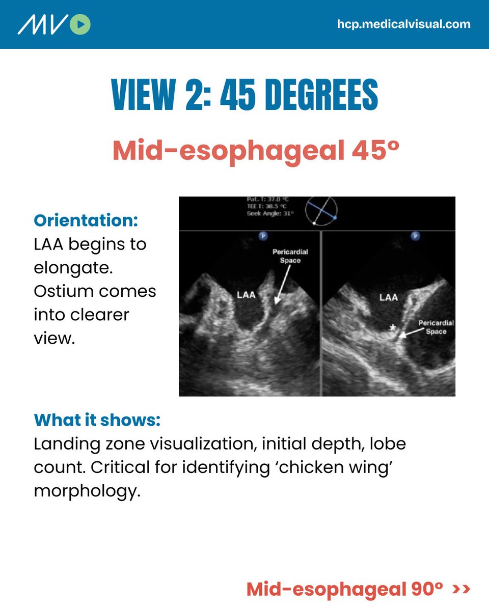 CardioVisual: Powered by MedicalVisual tweet media