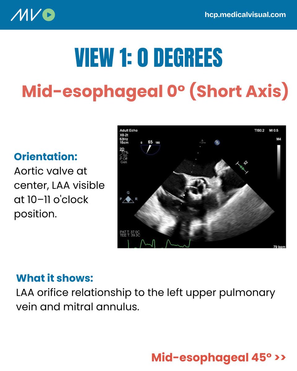 CardioVisual: Powered by MedicalVisual tweet media